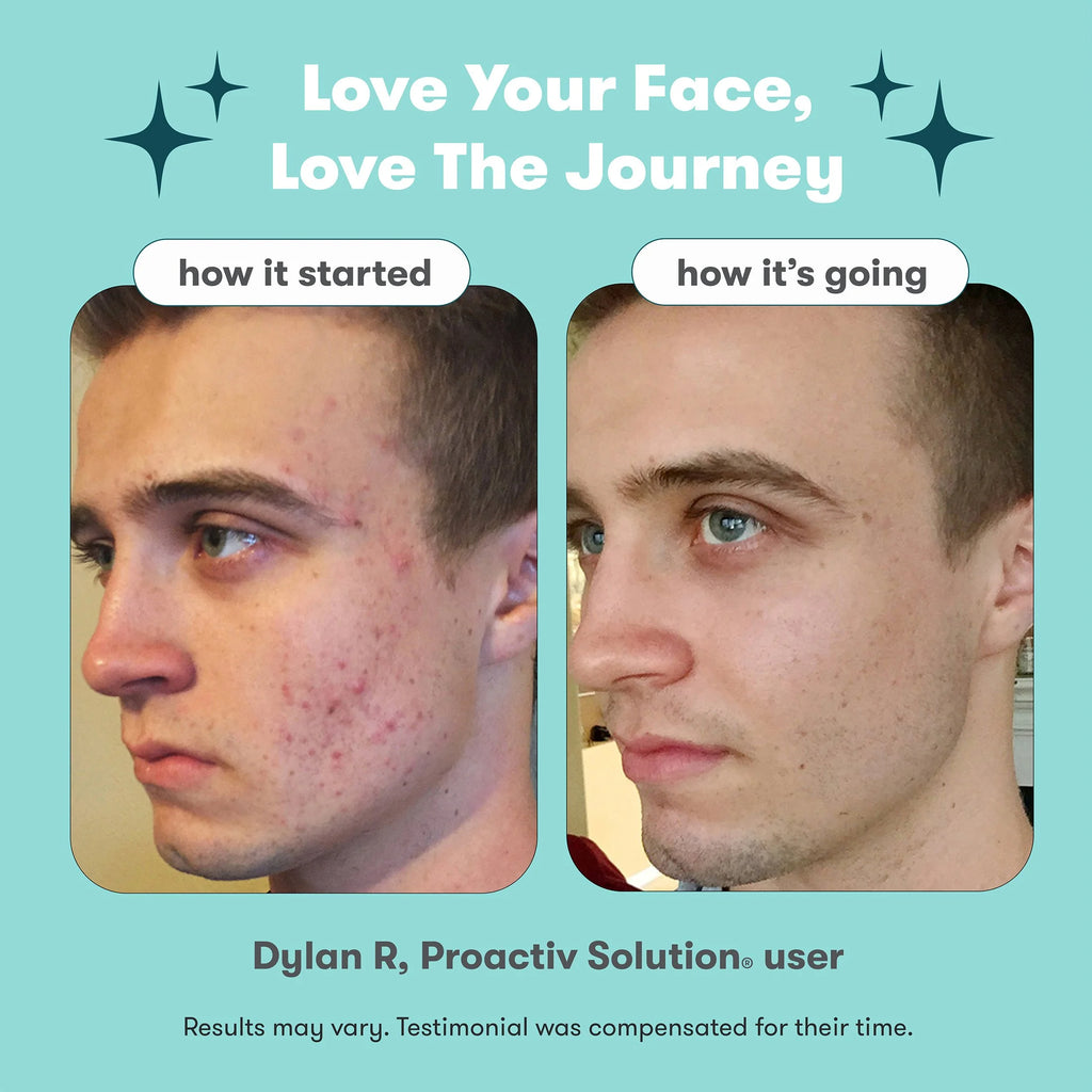 Proactiv Solution 3-Step Mini Acne Treatment System